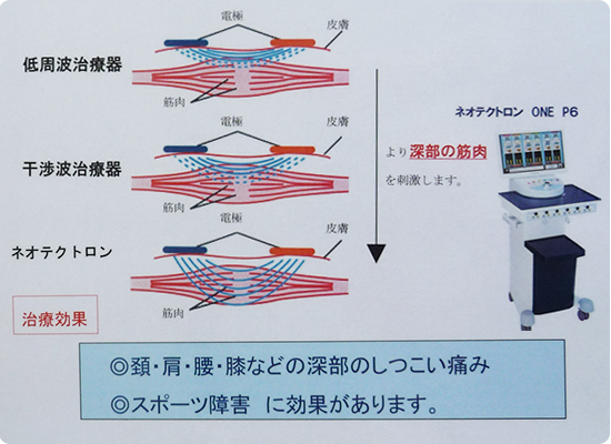 高周複合波治療器